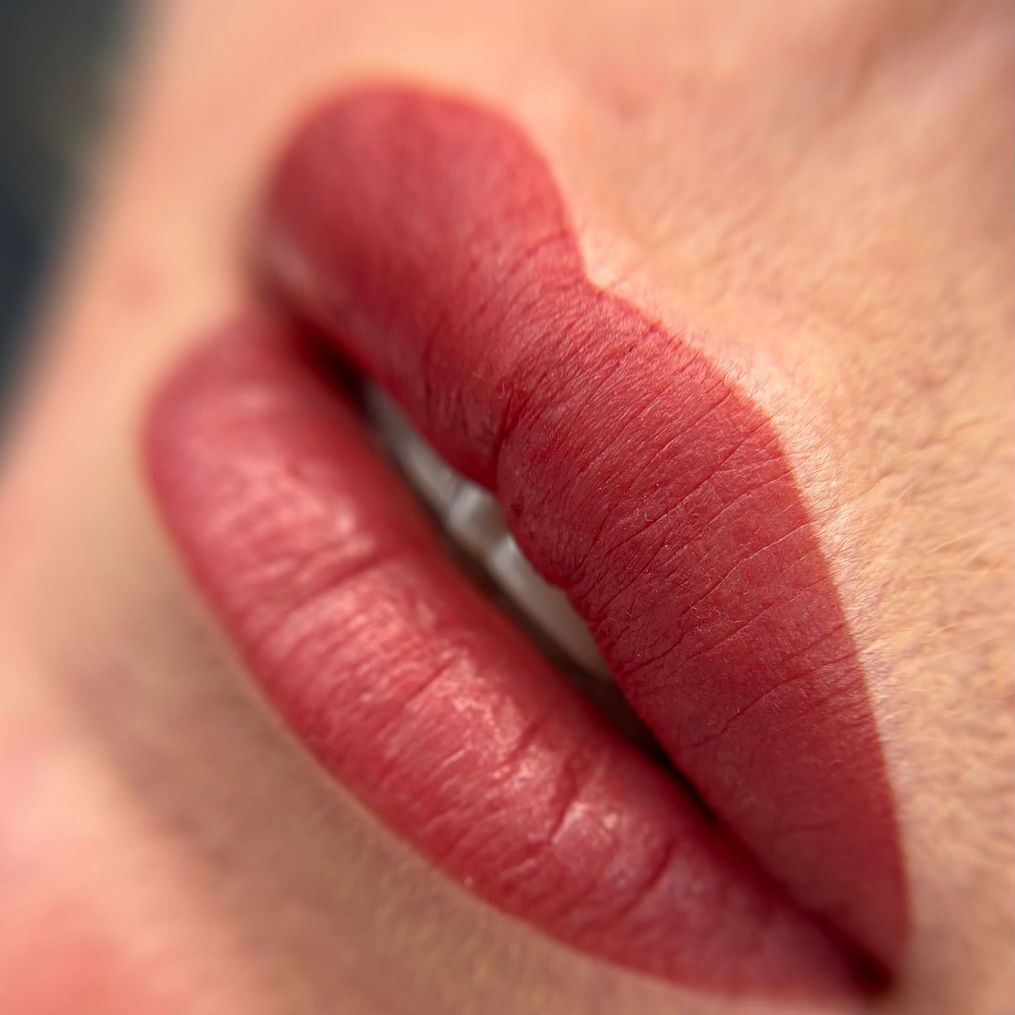 Lippen na de behandeling