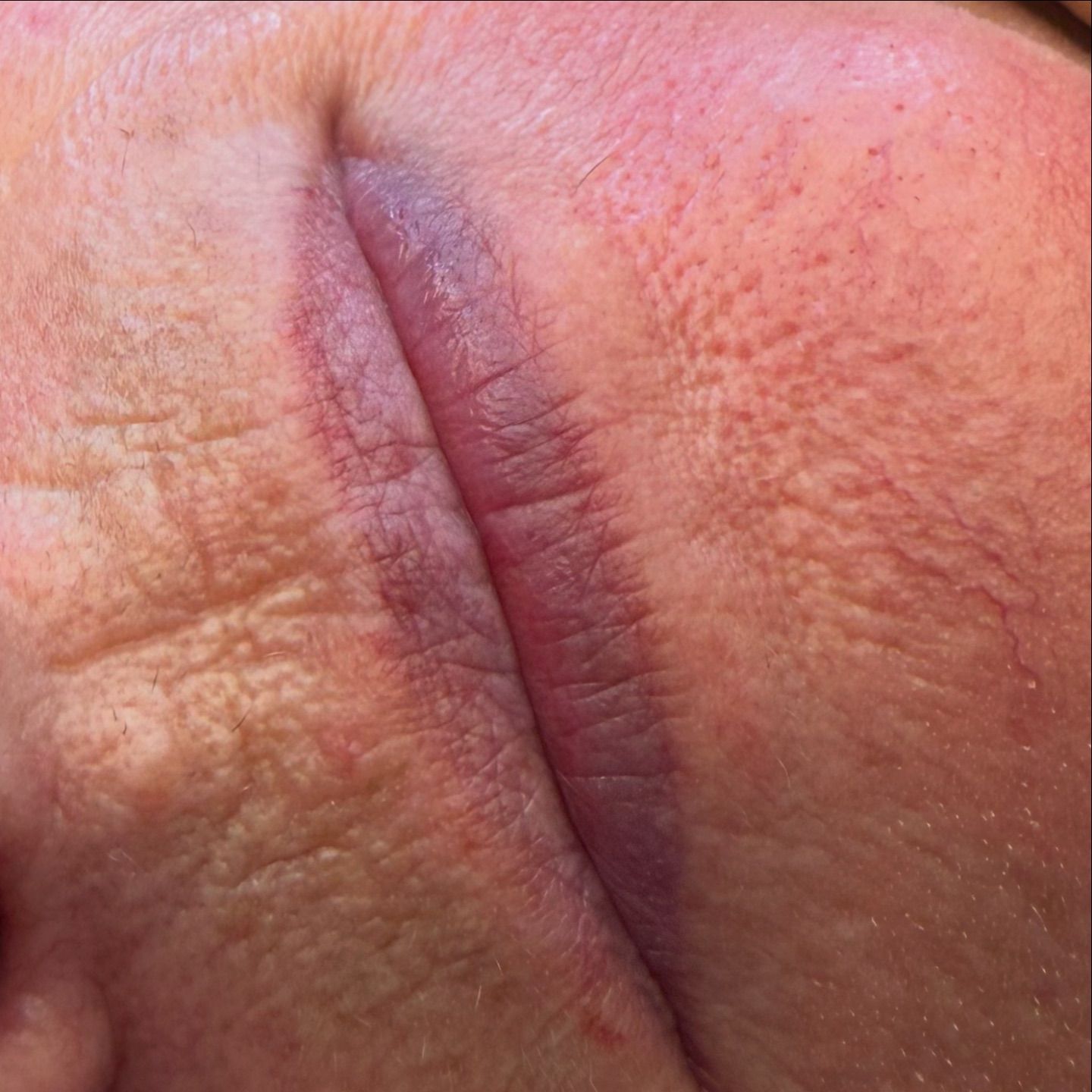 Lippen voor de lippigmentatie